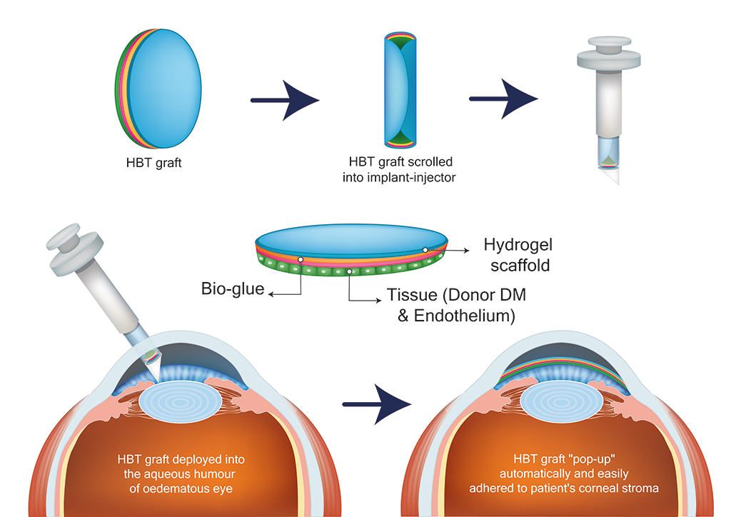 Hygelix schematic